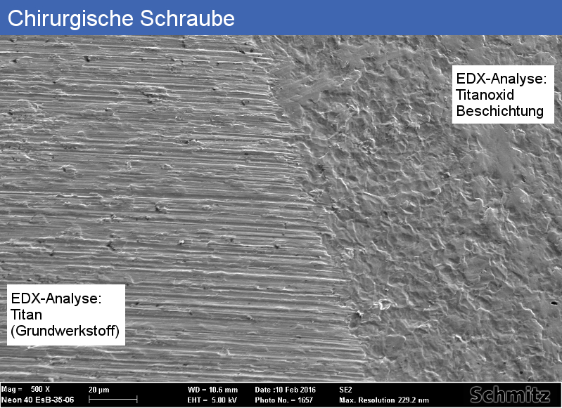 Chirurgische Schraube - 2