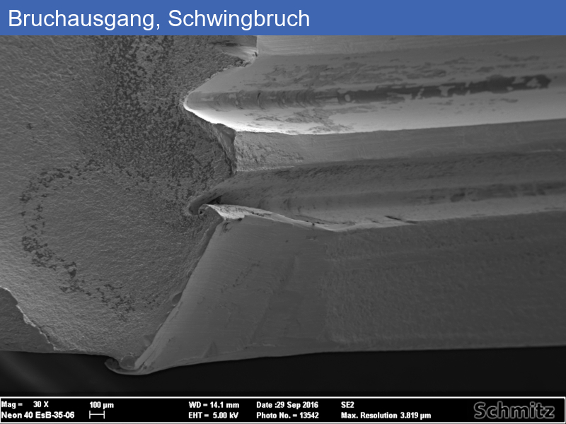 Fatigue fracture of an osteosynthesis plate - 06