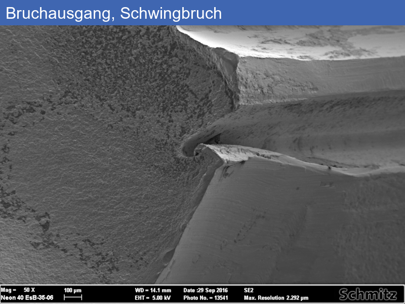 Fatigue fracture of an osteosynthesis plate - 07