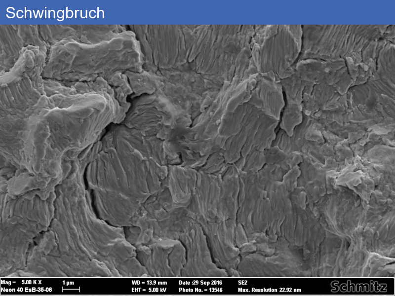 Fatigue fracture of an osteosynthesis plate - 08