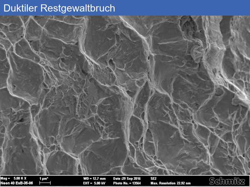 Fatigue fracture of an osteosynthesis plate - 09