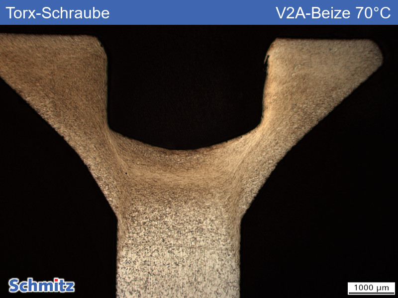 Torx-Schraube A2 - 01