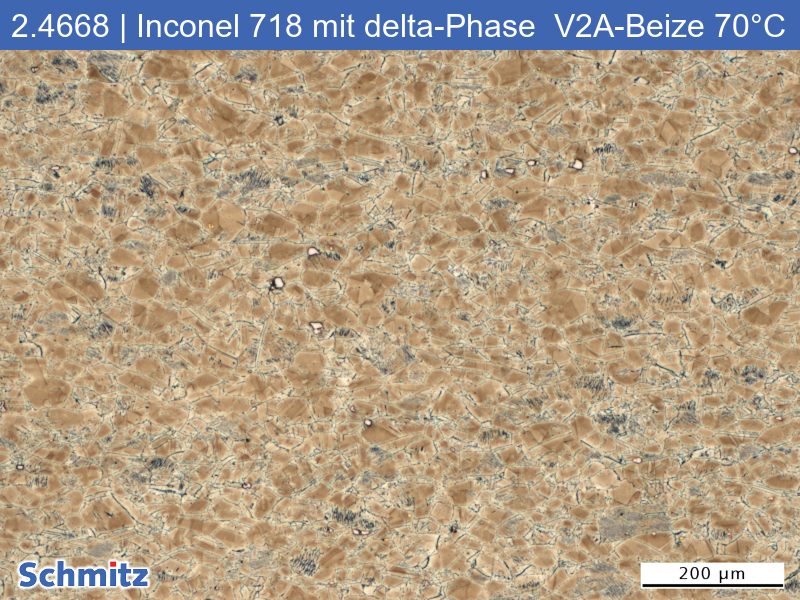 2.4668 | Inconel 718 mit delta-Phase - 01